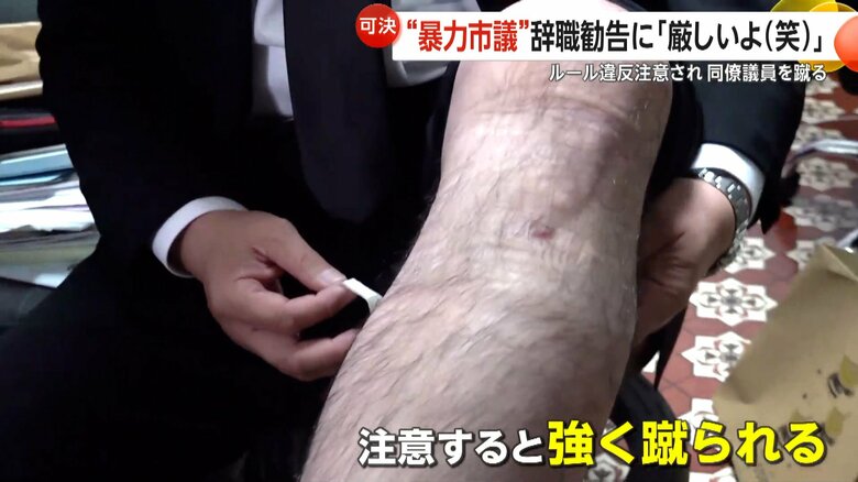 三田市議に蹴られた小林市議の膝のケガ