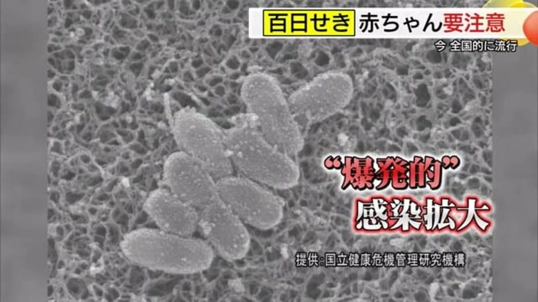 「百日咳」2025年の累計感染者…島根県92人　鳥取県189人　患者数の増加続き注意呼びかけ｜FNNプライムオンライン