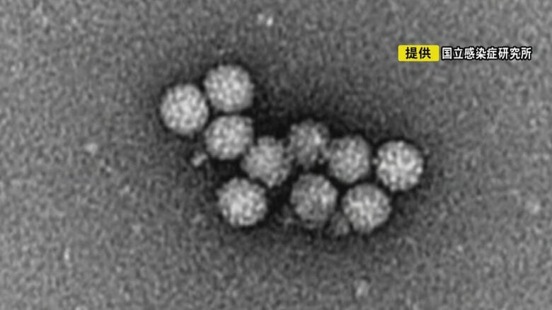 実はアルコール消毒効かず…ノロウイルスによる食中毒を防ぐには 厄介な3つの特徴と今の時代ならではの注意点｜FNNプライムオンライン