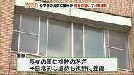 頭に複数のあざも…日常的虐待か 小学生の娘への傷害容疑で父親逮捕 静岡・牧之原警察署