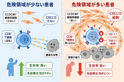 胃がんの進行を促進する「危険領域」を特定！― CCDC80陽性線維芽細胞による免疫抑制メカニズムの解明 ―