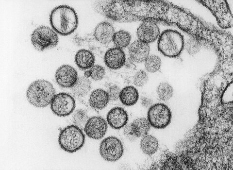 ハンタウイルス感染者は計6人に　いずれも「アンデス株」　新たにクルーズ船から降りた男性1人が感染疑い　WHO発表