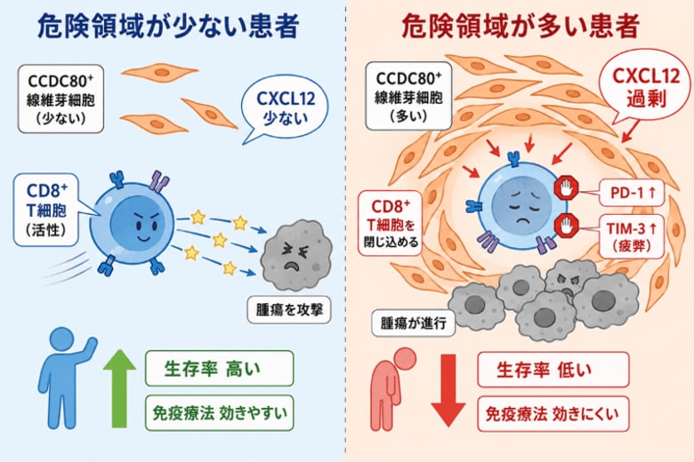 胃がんの進行を促進する「危険領域」を特定！― CCDC80陽性線維芽細胞による免疫抑制メカニズムの解明 ―