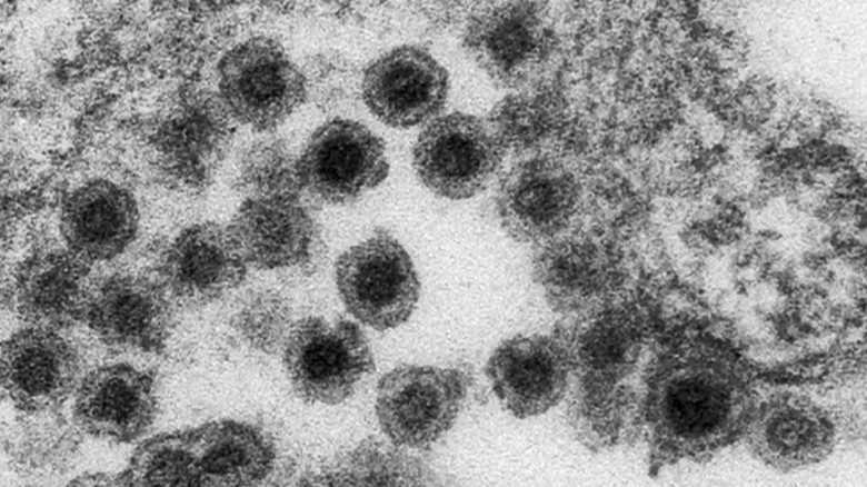 風疹の感染が急拡大中…9割が30~50代男性発症のワケとは?