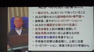 ALS患者でもある医師「患者の自己決定権を尊重してほしい」　難病の日を前に講演会　参加者は理解深める