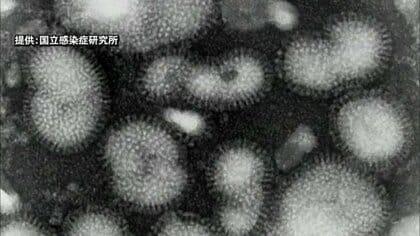 インフルエンザの感染拡大が止まらず…早くも「警報」発表　過去10年で最速　学級閉鎖も相次ぐ　福井　　