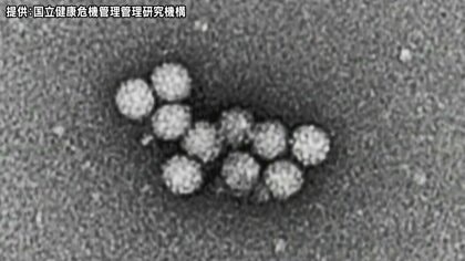 弁当、仕出し料理を食べ…10歳未満の子ども含む26人が下痢、腹痛など症状　ノロウイルスによる食中毒と断定