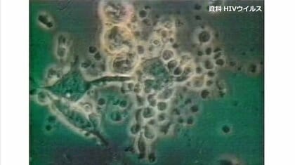 HIV感染の受刑者　治療中断で「エイズ」発症　「手錠のまま病院行きたくない」受刑者が治療拒否　「適切な情報の引き継ぎ」弁護士会が警察に求める