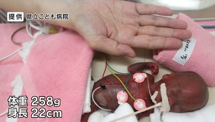 世界最小赤ちゃん」すくすく3歳に 少し大きめのスーツで「七五三参り