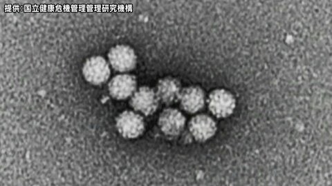 ウィンタースポーツの合宿で来た中学生18人に嘔吐、下痢などの症状　長野・野沢温泉村の旅館でノロウイルスによる食中毒が発生　患者と調理従事者の便からウイルスを検出