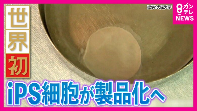 世界初「iPS細胞製品」実用化へ「心筋シート」と「パーキンソン病治療製品」　発表から20年の年に大躍進　京大・藤井教授「こういう投資ができる国は未来を掴むことができます」研究への投資にさらなる期待｜FNNプライムオンライン