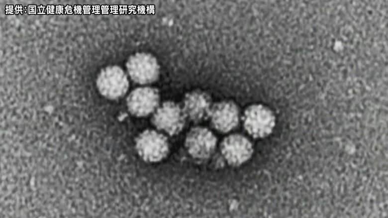 弁当、仕出し料理を食べ…10歳未満の子ども含む26人が下痢、腹痛など症状　ノロウイルスによる食中毒と断定｜FNNプライムオンライン