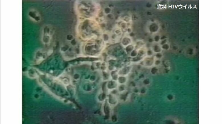 HIV感染の受刑者　治療中断で「エイズ」発症　「手錠のまま病院行きたくない」受刑者が治療拒否　「適切な情報の引き継ぎ」弁護士会が警察に求める｜FNNプライムオンライン