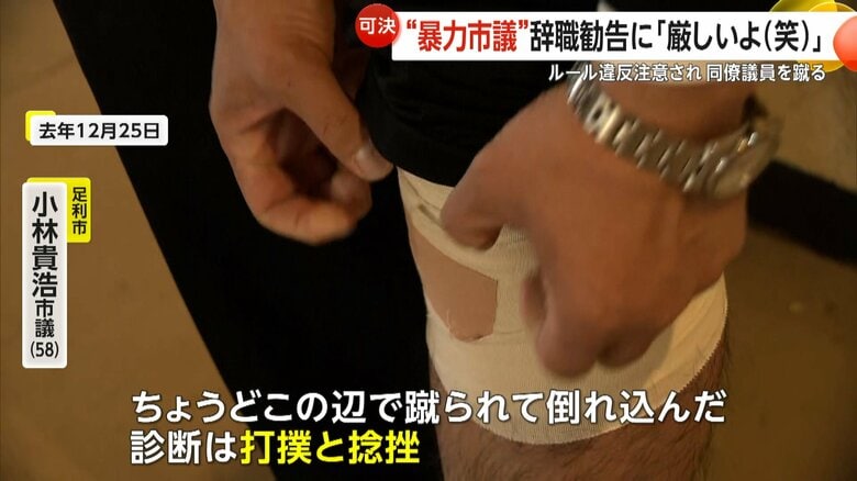 三田研三市議に蹴られた膝を見せる小林貴浩市議