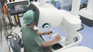 「内臓や血管にかかる圧力よりリアルに」国内初・最新型手術ロボット「ダビンチ5」で大腸がん手術　大阪の病院「出血ほとんどゼロ　優しく手術」