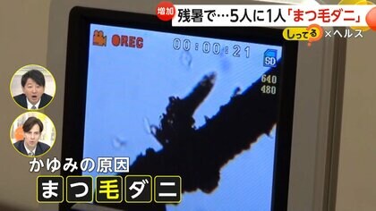 残暑で異常繁殖…5人に1人は「まつ毛ダニ」　目のかゆみや炎症引き起こす　油っぽい食事やメイクの落とし忘れも原因に