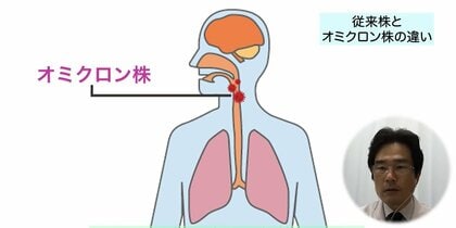 オミクロン株の潜伏期間は3日程度、風邪との違いは「高熱」…従来株との違いと感染防止策を専門医が解説