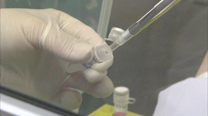 「新型コロナの薬は7～8万円」　“インフル並み”「5類」になると自己負担額は？【岡山発】