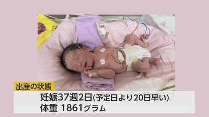 小さく生まれても大きな可能性を秘めて 〜1861グラムの低出生体重児で