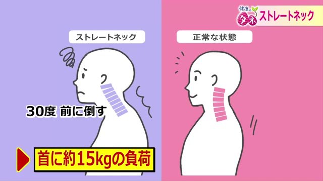 ストレートネックとは