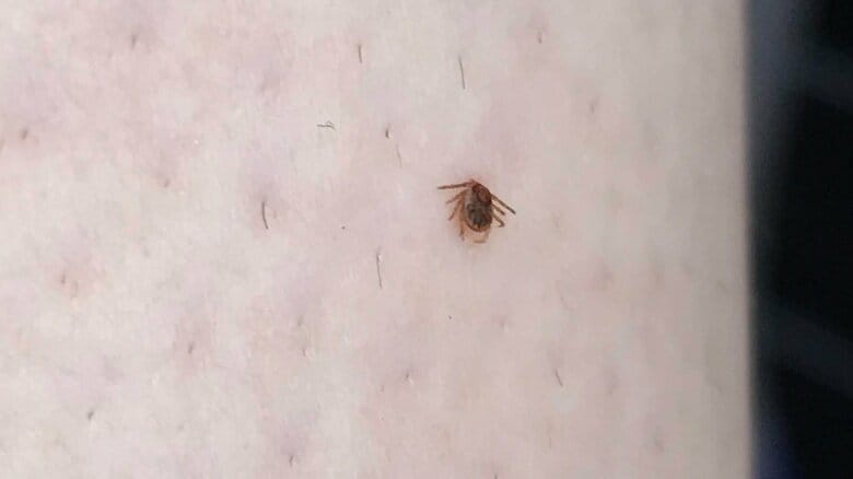 かみつくマダニ（画像提供：西海太介さん）