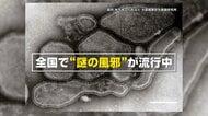 【専門家解説】「せきが止まらない、長引く」“謎の風邪”の正体！？ヒトメタニューモウイルスとは？