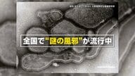 【専門家解説】「せきが止まらない、長引く」“謎の風邪”の正体！？ヒトメタニューモウイルスとは？