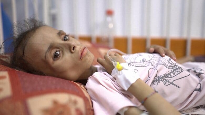 深刻な飢餓に襲われるガザ地区の人