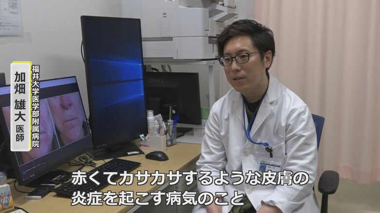 福井大学医学部附属病院の加畑雄大医師