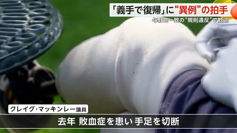 敗血症を患い、手足を切断したマッキンレー議員の義足