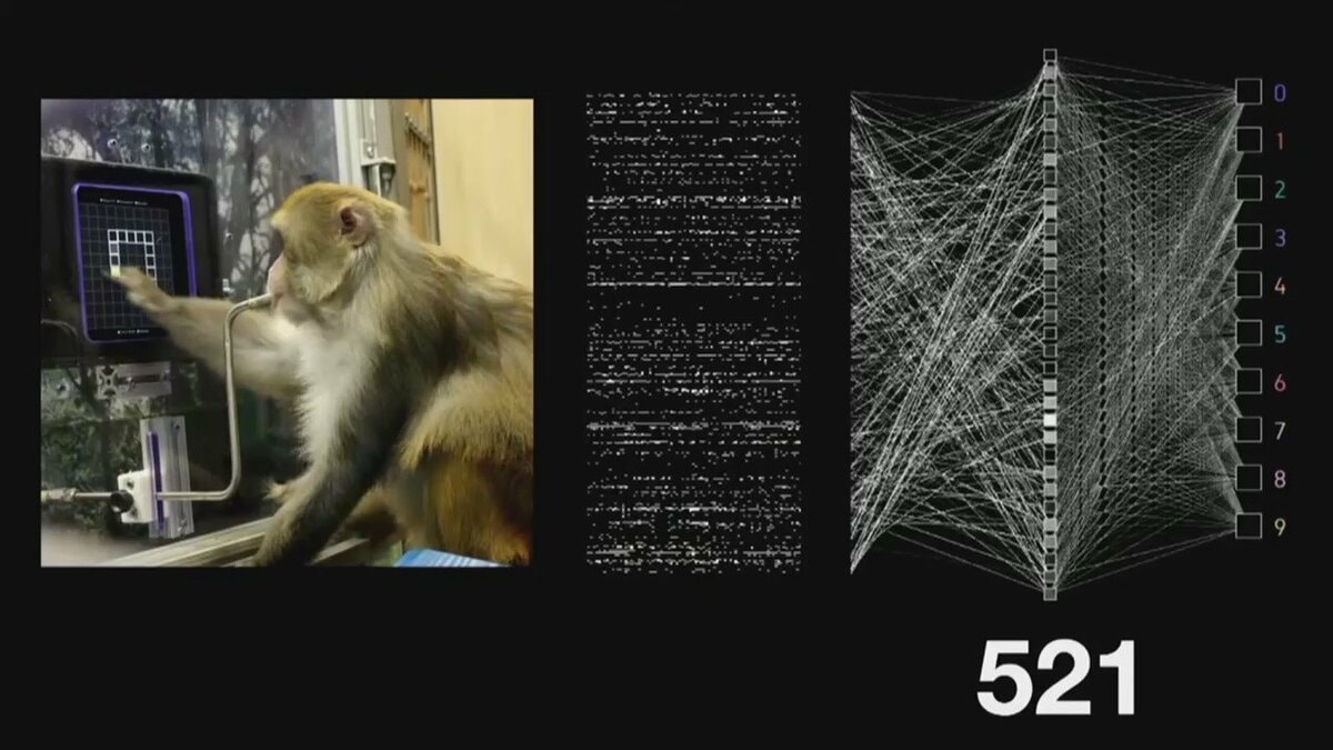 思考”だけでPC操作可能に？脳内チップ臨床試験の参加者募集 イーロン・マスク氏が共同創設のニューラリンク社｜FNNプライムオンライン
