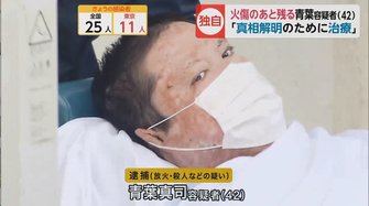 アニ 者 火傷 被害 京