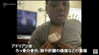 助けを求めて通報した11歳少年に警察官が発砲　米・ミシシッピ州