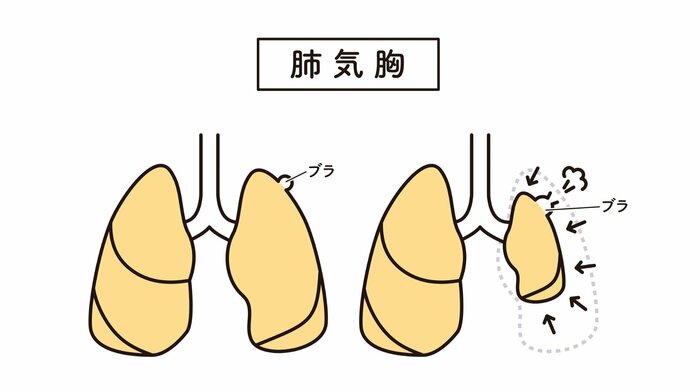 (イメージ)