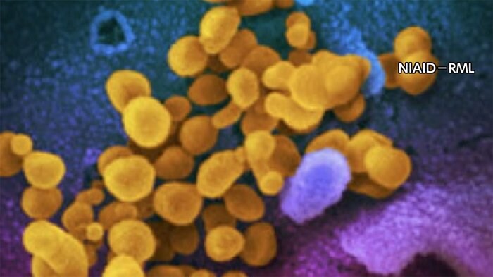 新型コロナ 東京都で新たに263人の感染確認
