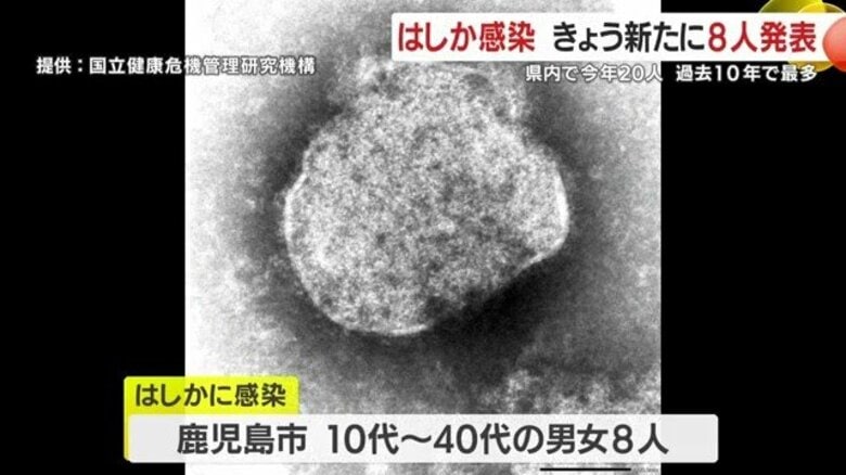 鹿児島市で「過去10年で突出」　はしか感染20人に、3月23日新たに8人発表　うち6人はワクチン接種済み｜FNNプライムオンライン