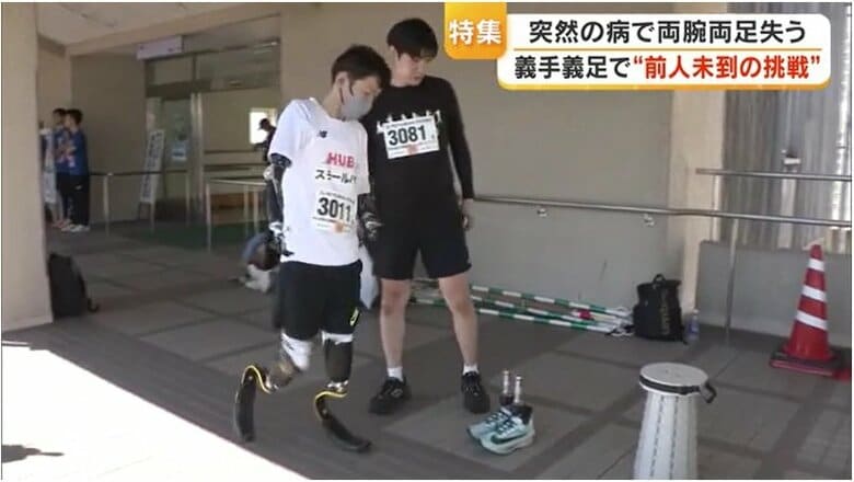 スポーツ用の義足に履き替える