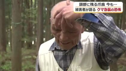 「目ん玉引きちぎられるかと…」クマに襲われた78歳男性が恐怖体験を語る　福井でも連日クマの目撃情報　“出会わない”対策を　