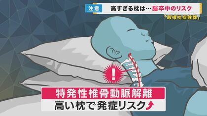 低すぎる枕 口呼吸 論文 オファー