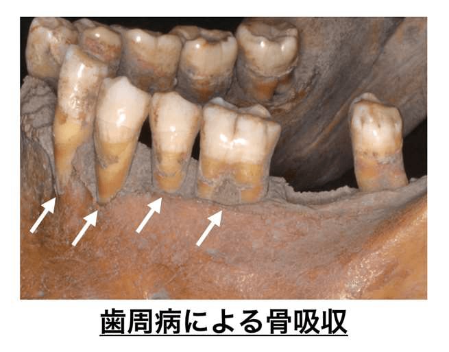 (出典:東京医科歯科大学)