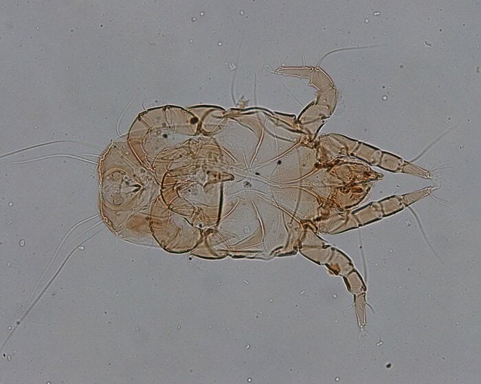 チリダニの一種であるヤケヒョウヒダニ（画像はイメージ）