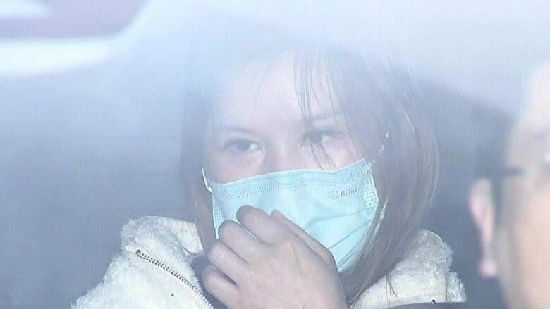 二重まぶた切開で「顔が化膿している」中国人3人を医師資格なく美容医療行為した疑いで逮捕　東京・池袋のマンション一室で女性客2人に手術　｜FNNプライムオンライン