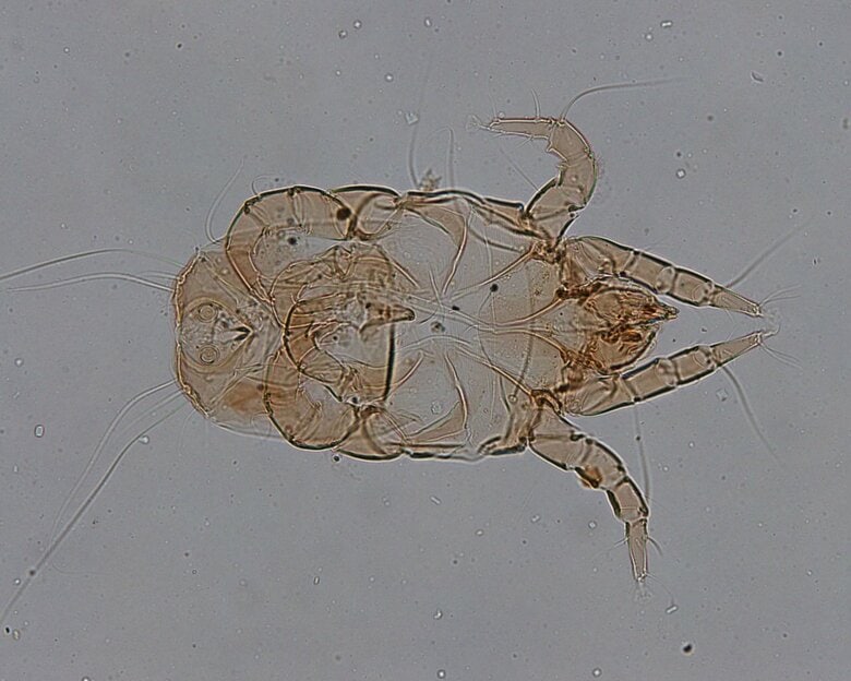 チリダニの一種であるヤケヒョウヒダニ（画像はイメージ）