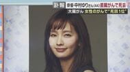 中村ゆりさん　大腸がんの一種「直腸がん」で死去　初期症状は出やすいものの検査が遅れ「切除不能」のケースも　直腸がんを経験した医師が語る検査の重要性と治療のイマ