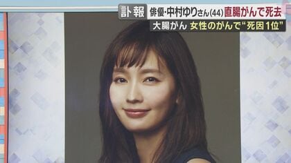 中村ゆりさん　大腸がんの一種「直腸がん」で死去　初期症状は出やすいものの検査が遅れ「切除不能」のケースも　直腸がんを経験した医師が語る検査の重要性と治療のイマ
