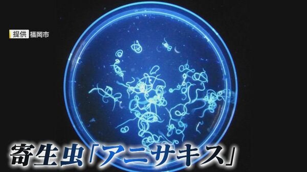 3月最多 食中毒に要注意！ 主な原因はアニサキスなど寄生虫 “電気