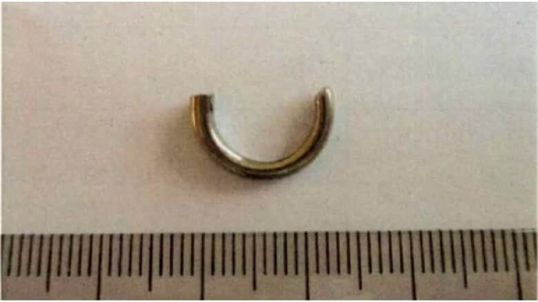 小学校の給食のご飯に「銀色のリング」の一部混入　児童が吐き出して発見（鳥取・米子市）｜FNNプライムオンライン