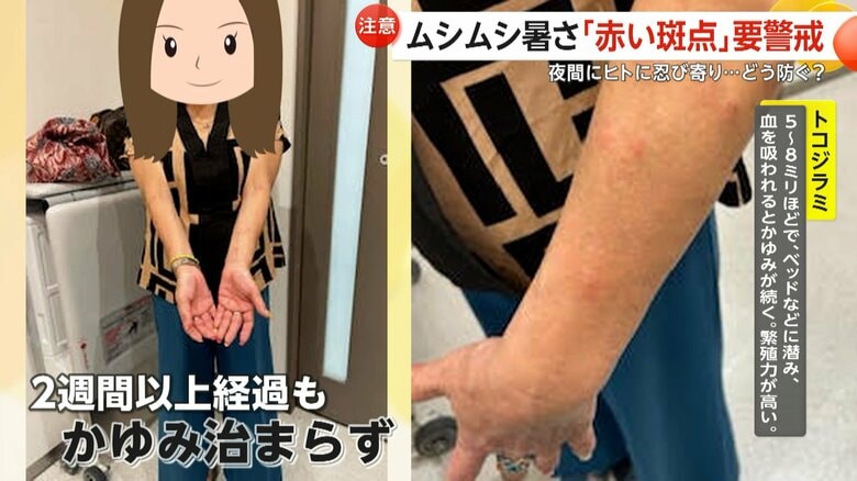 眠れないほどの痒みが続き、2週間以上収まらず