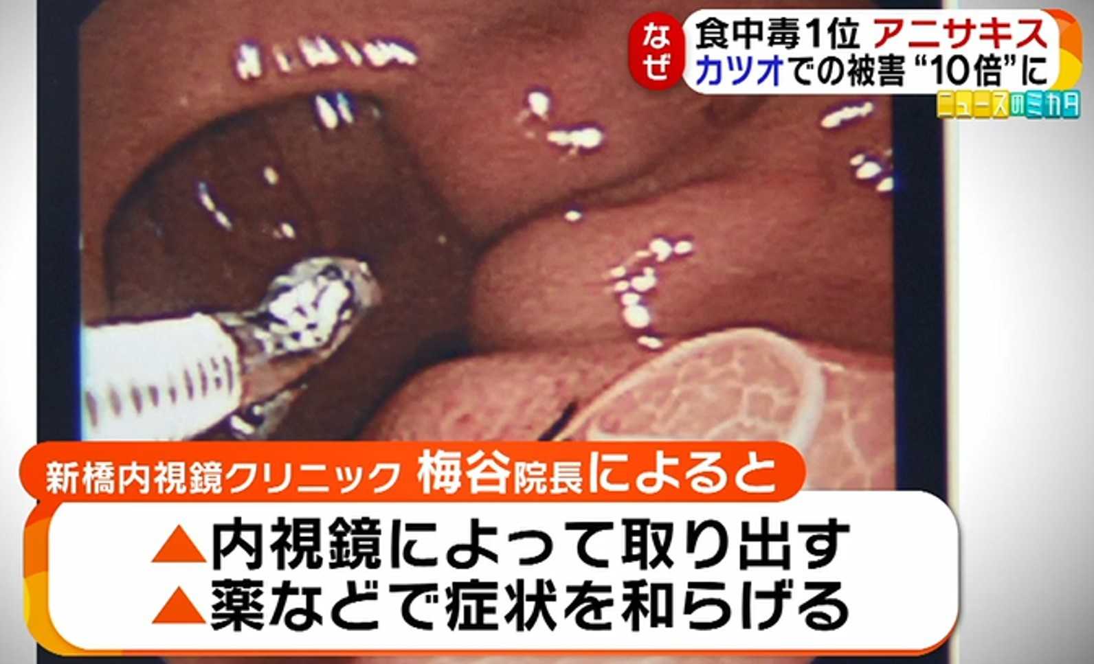 旬 を迎える初ガツオ アニサキスの食中毒被害が10倍に その対策とは