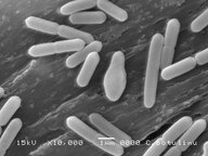 【危険】“最強の自然毒素”『ボツリヌス菌』による食中毒で50代女性が重症　要冷蔵食品を常温保管で…ブルーチーズのような臭いや味も　全身に麻痺症状